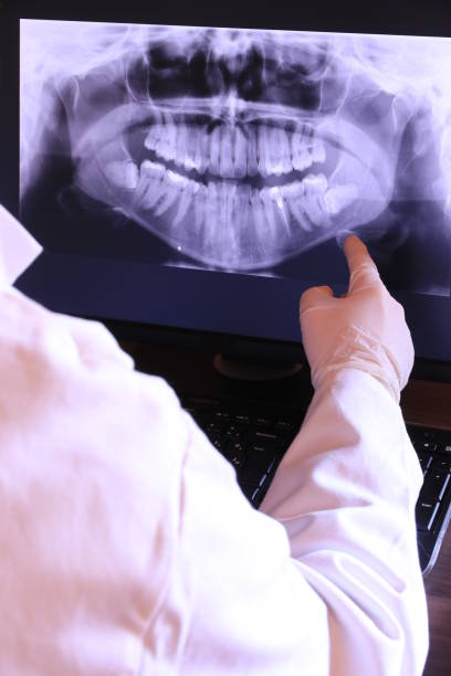 Best Emergency Denture Repair in Gardena, CA